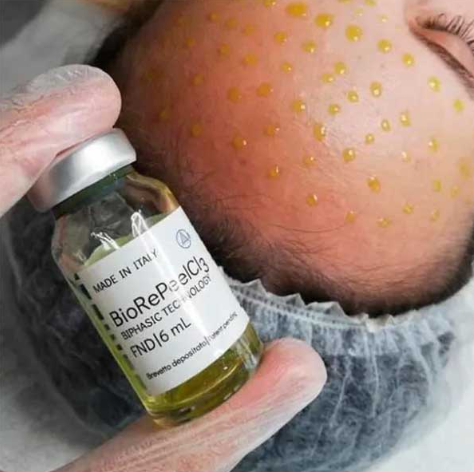 Radiate Confidence with BioRePeel at Vita Beauty Bar in Saskatoon