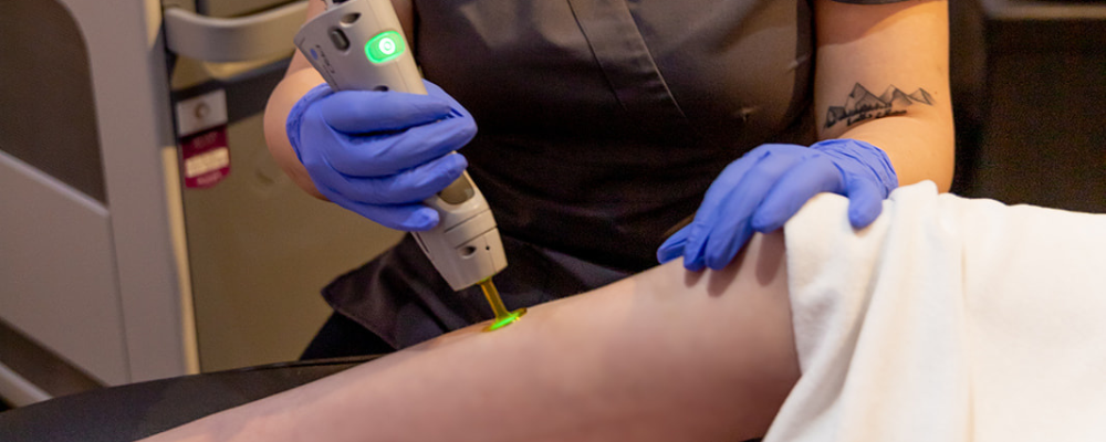 Top 5 Things to Tell Your Laser Tech