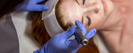 Everything You Need To Know About Microneedling