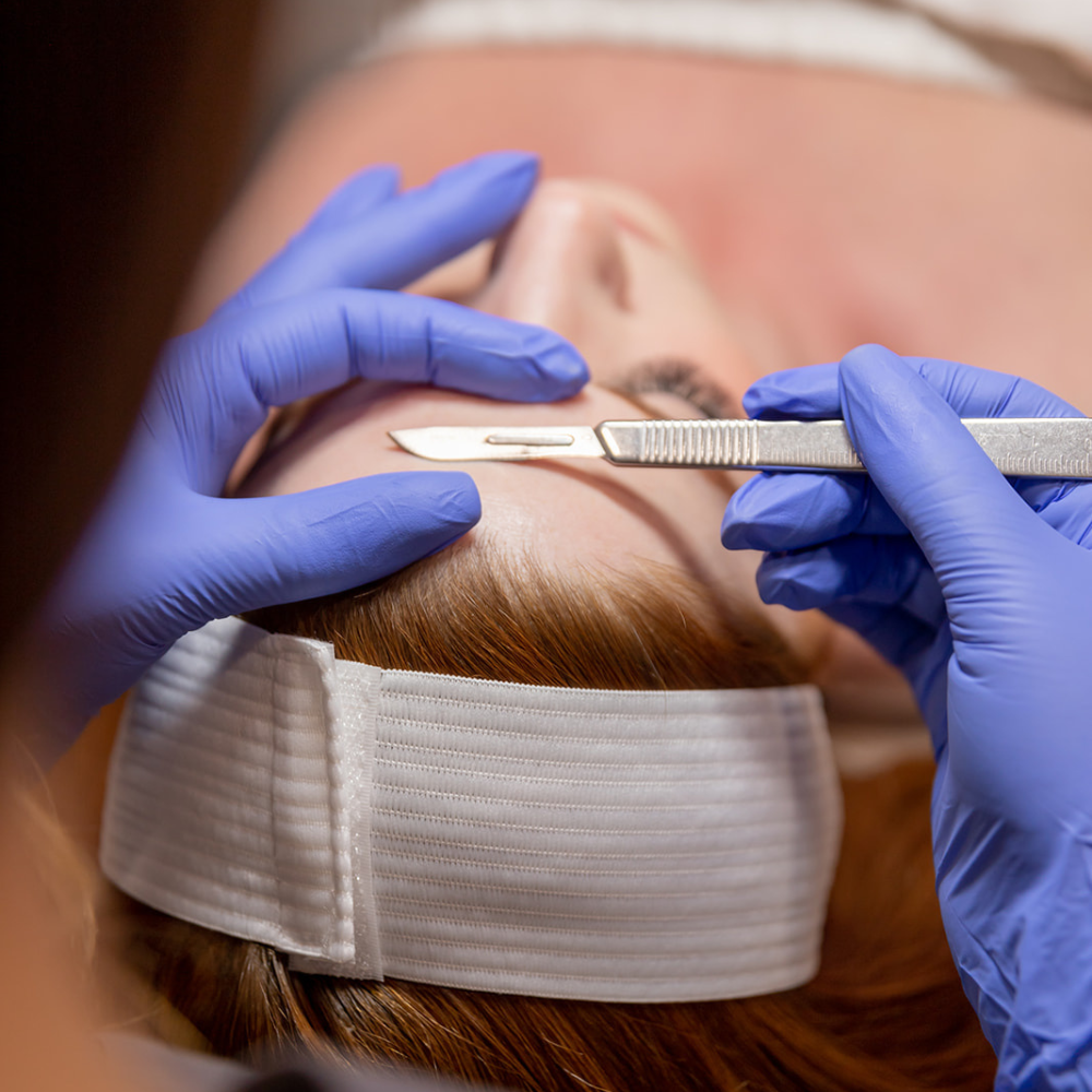Dermaplaning Facial - Vita Beauty Bar