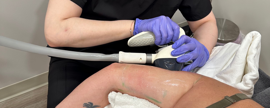 Velashape Body Contouring: What You Need to Know - Vita Beauty Bar